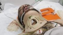 قرر الأطباء تنويم هارون أبو عرام بعد إصابته برصاصة في الرقبة (فيسبوك)