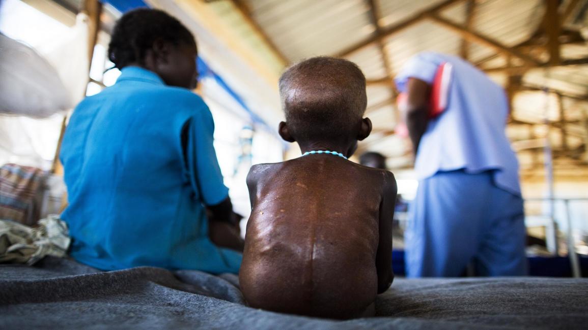 مجاعة في جنوب السودان(ألبرت غونزالس فران/فرانس برس)