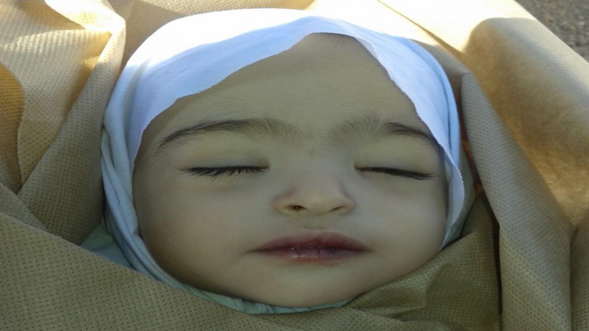 وفاة الطفلة السورية مرام في غوطة دمشق (فيسبوك)