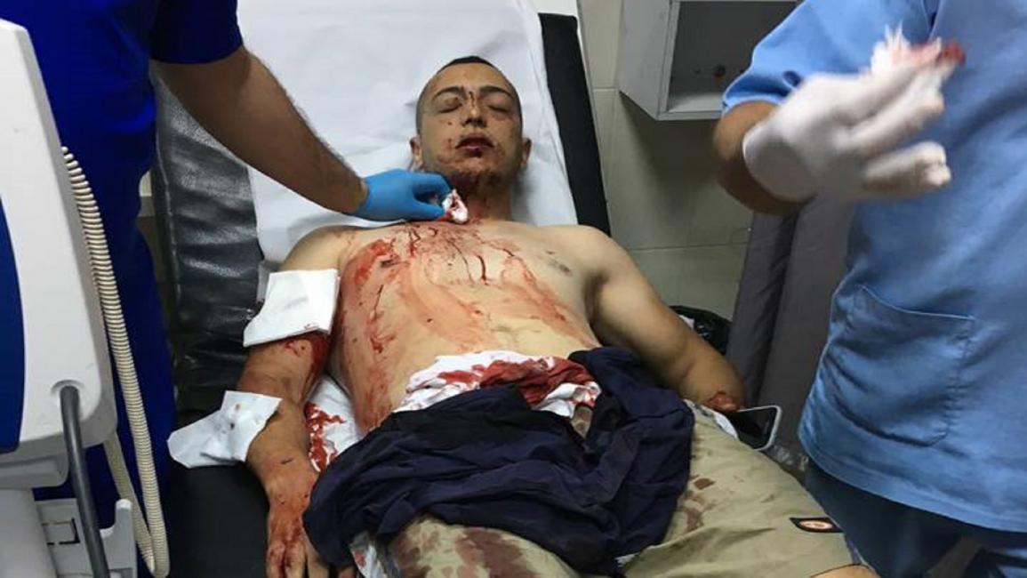 معتصم دندن بعد إصابته برصاص الشرطة الفلسطينية (فيسبوك)