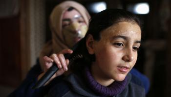 أصيبت مرام العماوي بحروق بالغة في وجهها (محمد عبيد/ فرانس برس)