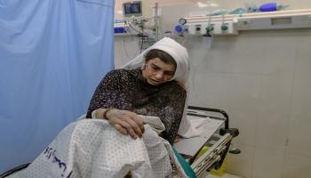 امرأة مصابة بسبب القصف الإسرائيلي في مشفى في خان يونس جنوب قطاع غزة في 30/ 10/ 2023 (فرانس برس)