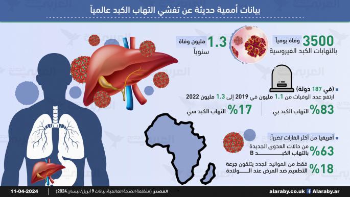 الأمم المتحدة: آلاف الوفيات يوميا بالتهاب الكبد والعدد آخذ بالارتفاع